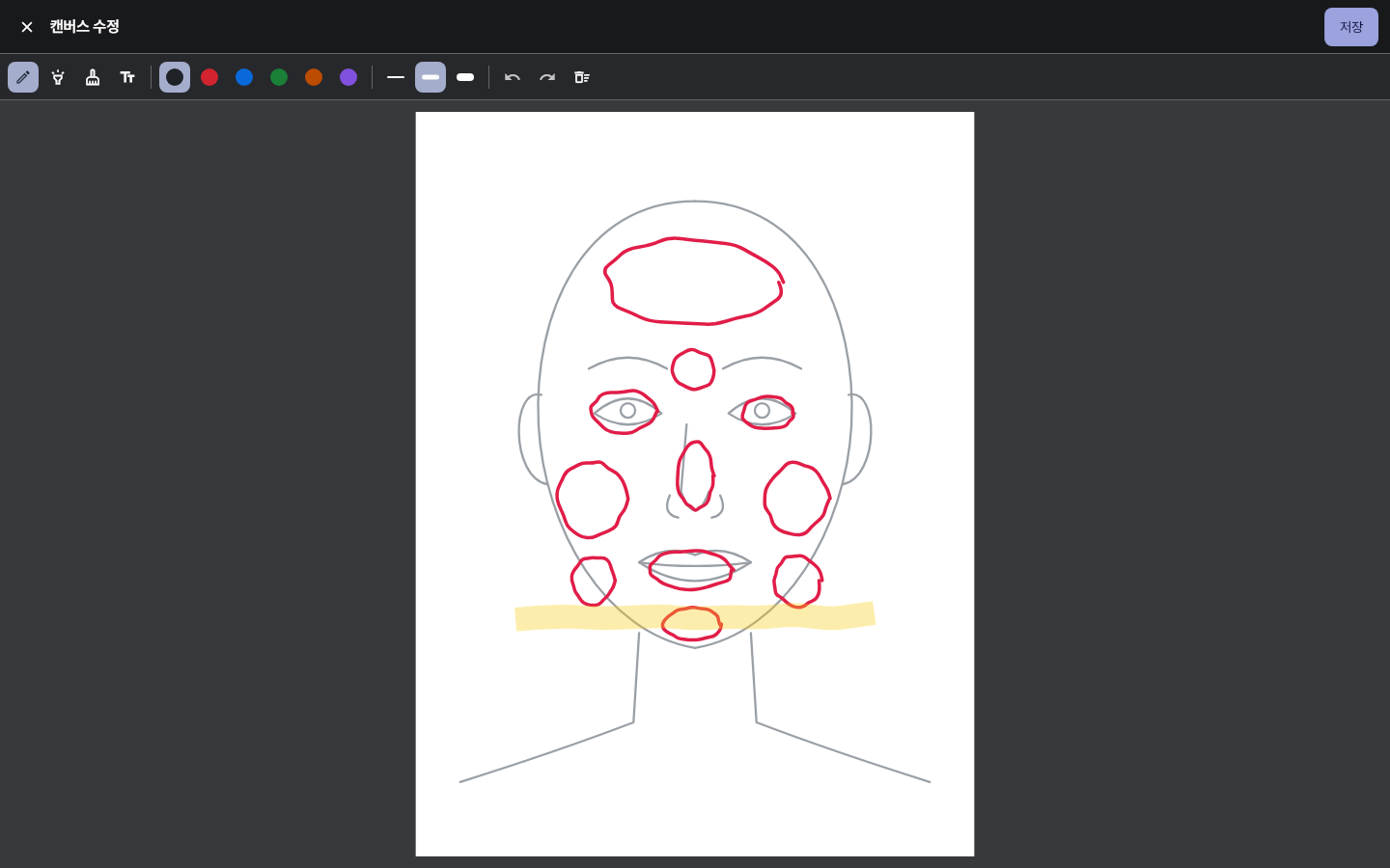 pen_chart_regions — clinic-pc · dark · ko