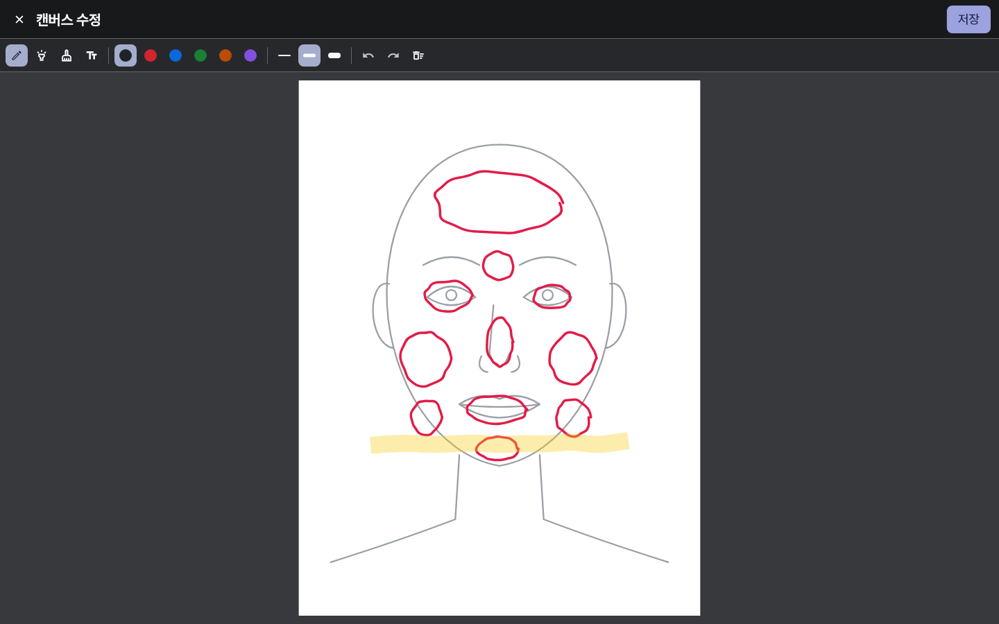 pen_chart_regions — clinic-pc · dark · ko · text 1.3x