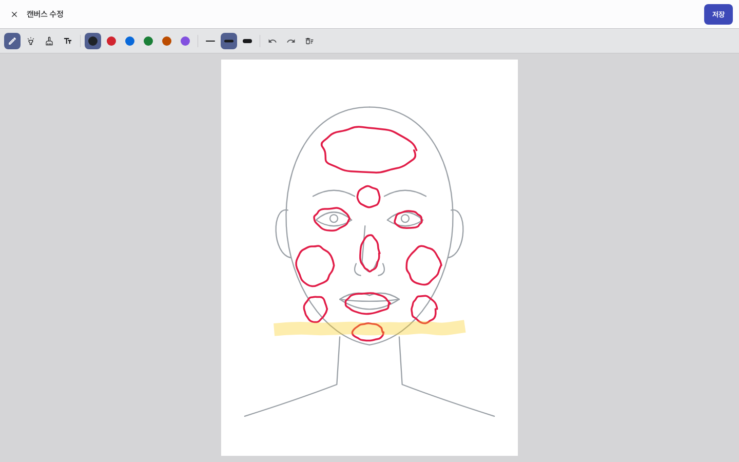 pen_chart_regions — clinic-pc · light · ko