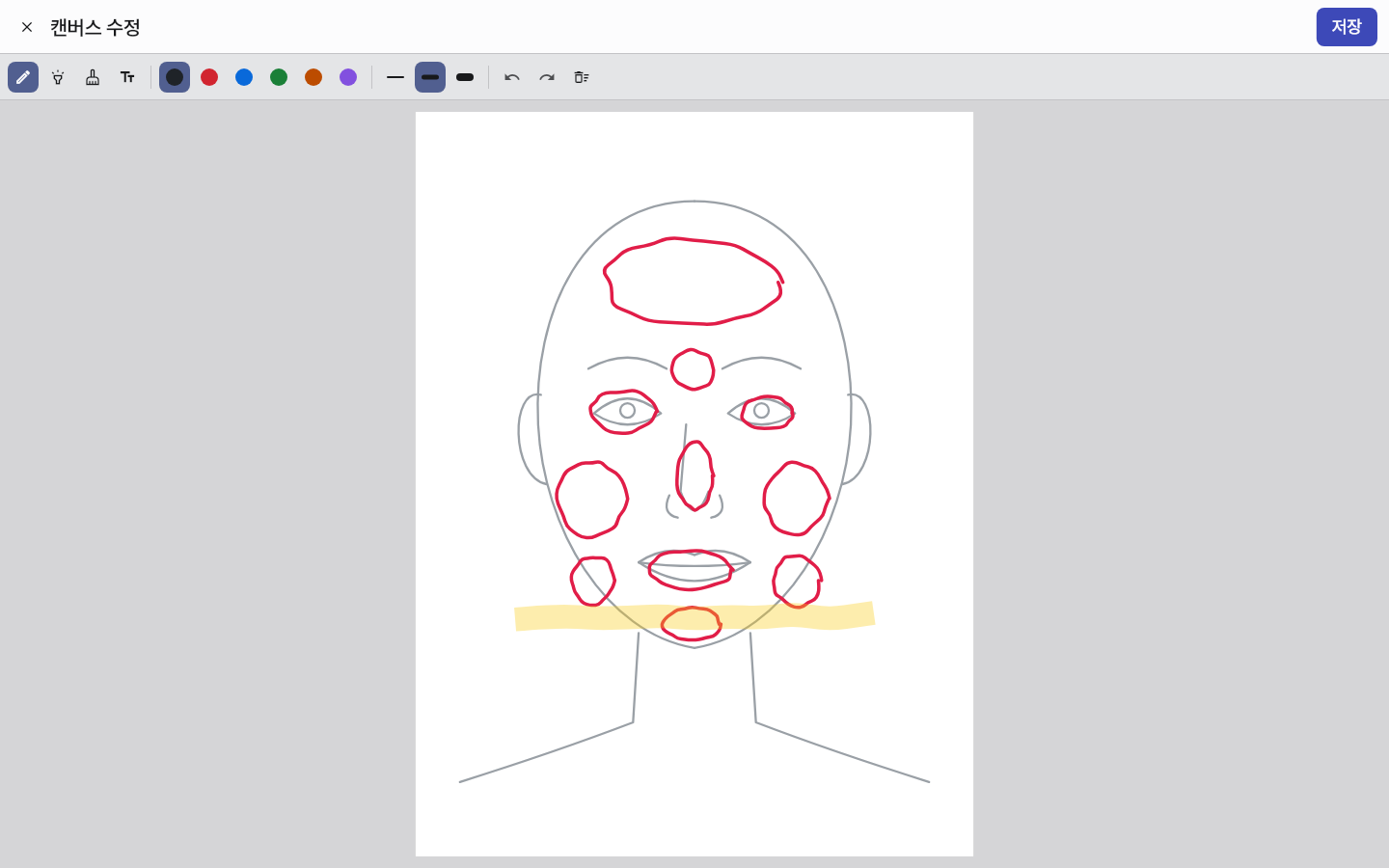 pen_chart_regions — clinic-pc · light · ko · text 1.3x